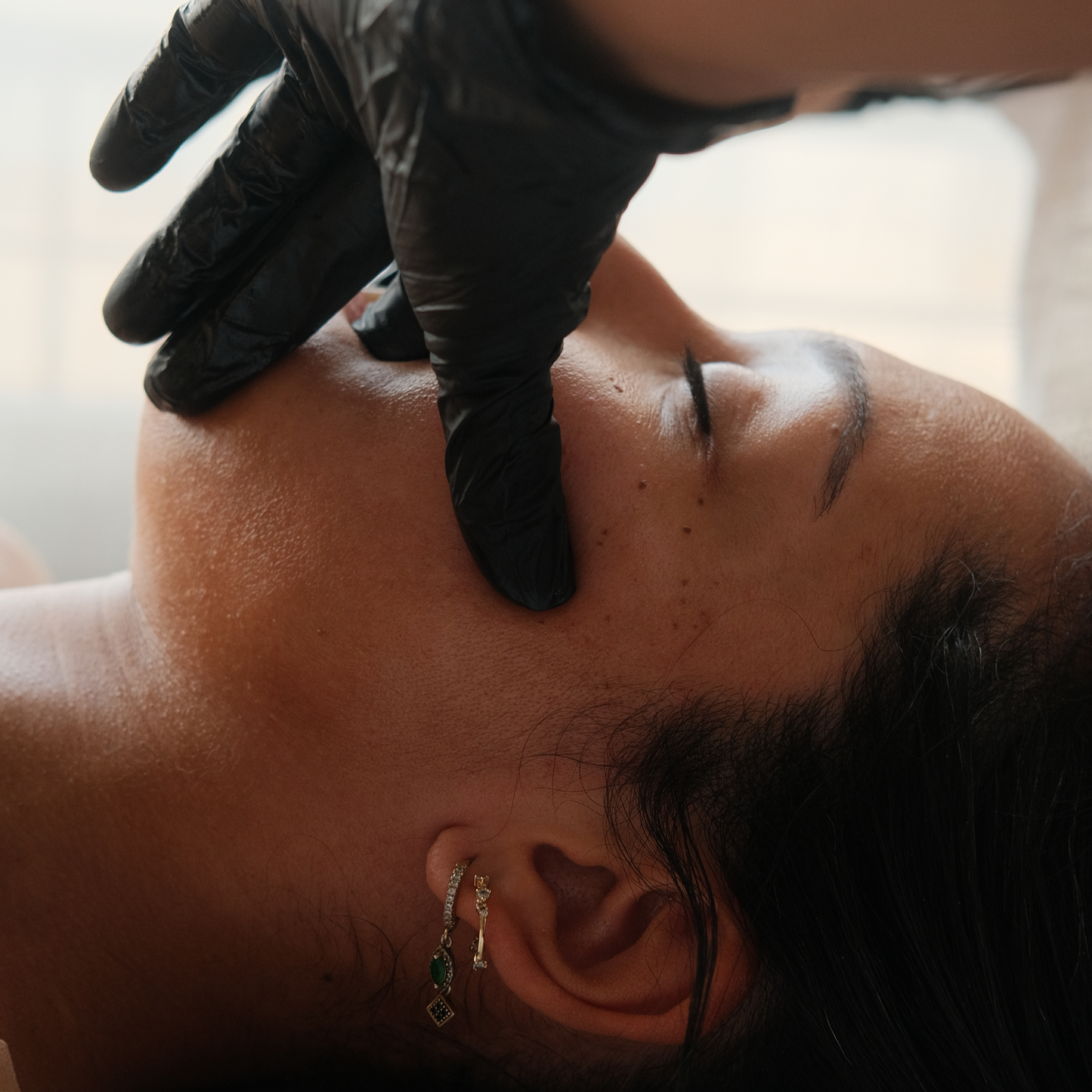 Neolifting – The Standard Experience